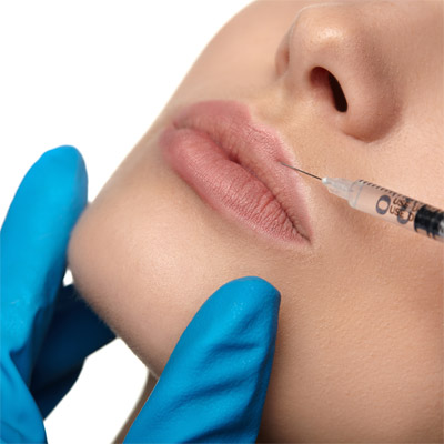 dermal fillers